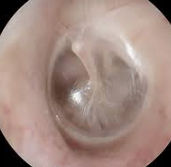 What are the main structures of the ear